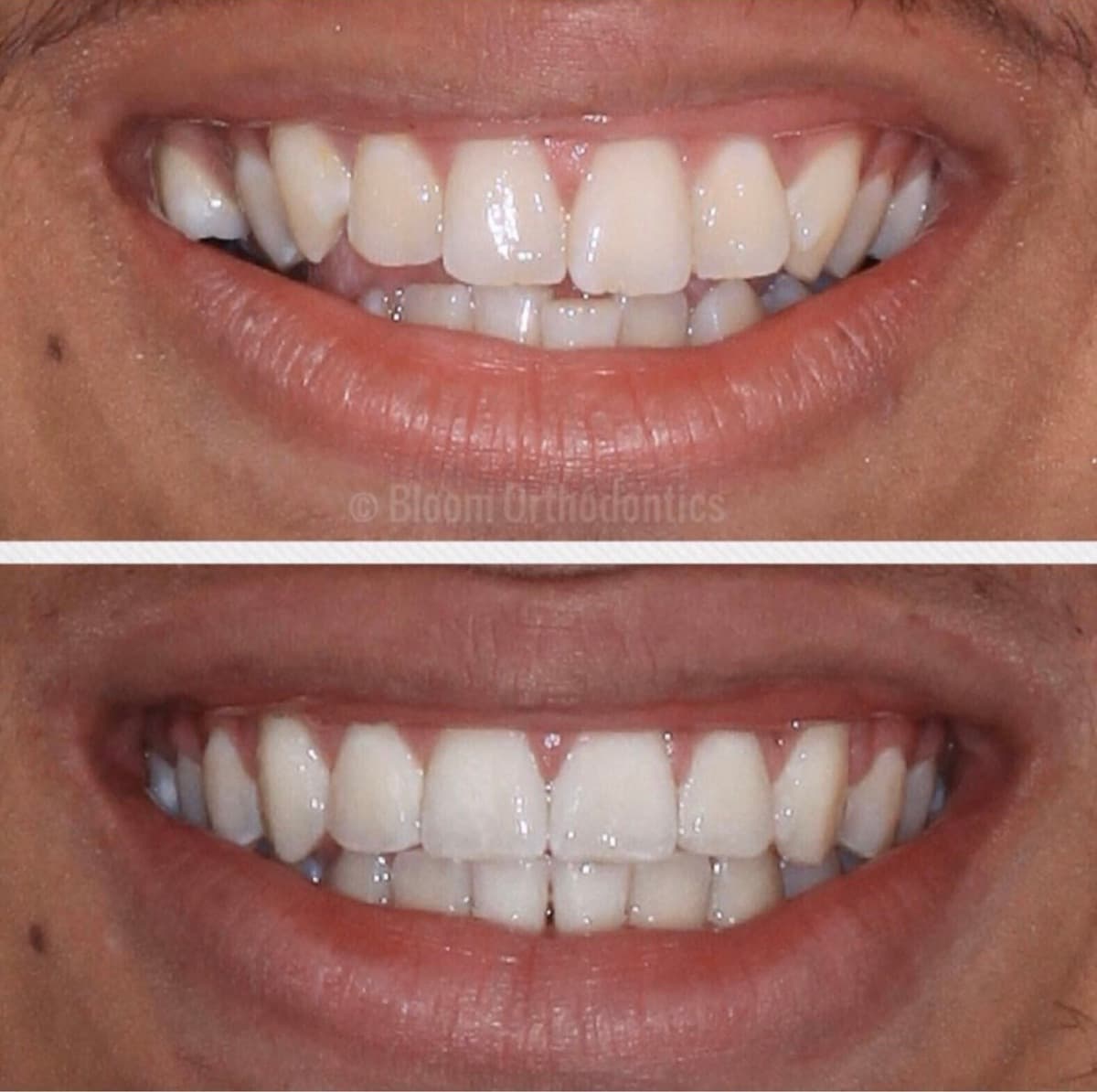 Spacing & Alignment — before and after